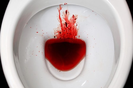 Fresh Blood In Stool And Nausea