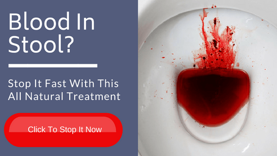 Blood In Your Poop What It Looks Like What It Could Mean – NBKomputer